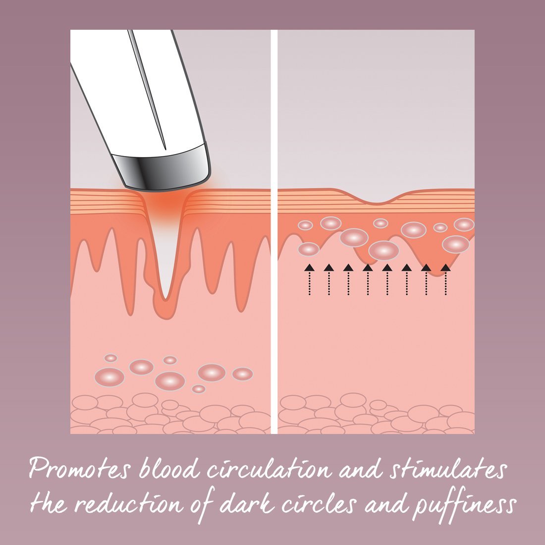 may lam dep mat cua my